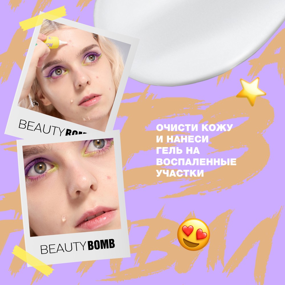 Точечный гель от прыщей для проблемной и жирной кожи Beauty Bomb Acne Fighter 15мл. Фото 7.