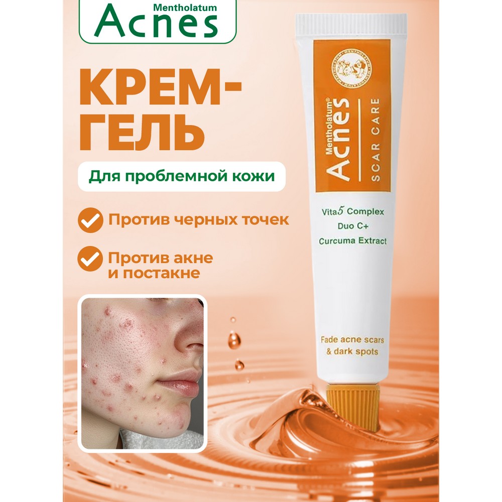 Гель для лица против акне, постакне и черных точек Mentholatum Acnes с экстрактом куркумы 12г. Фото 4.