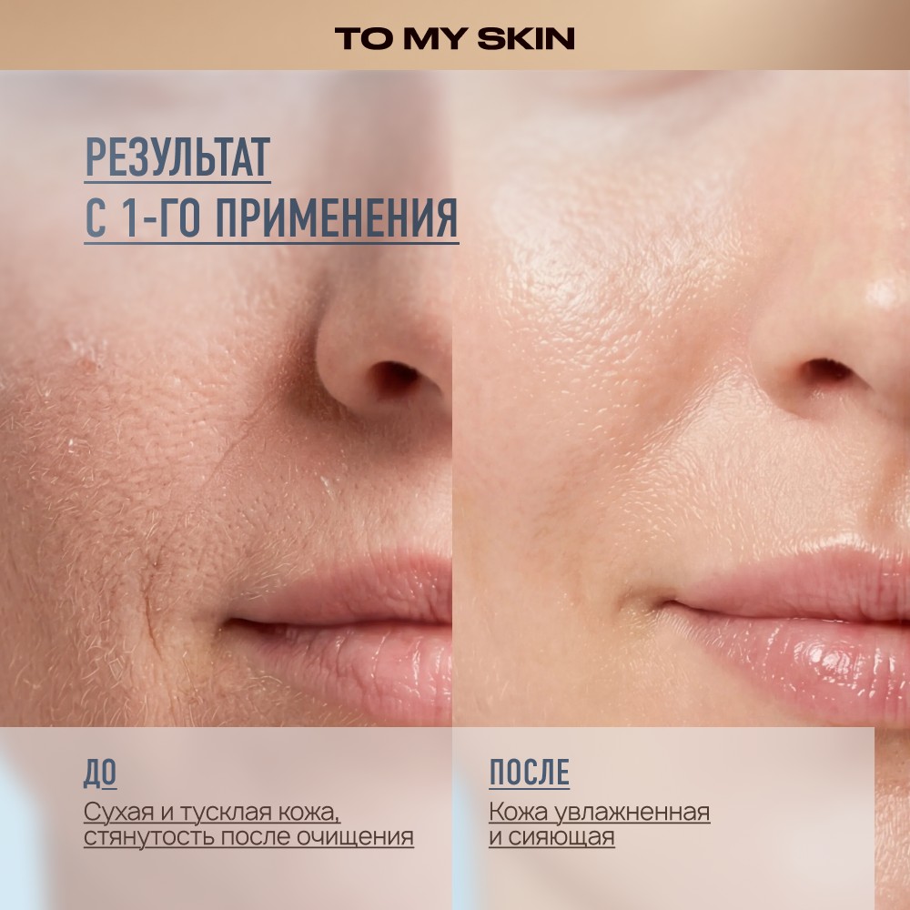 Интенсивно увлажняющий тонер для лица To My Skin Hyaluronic + Vitamin C 200мл. Фото 7.