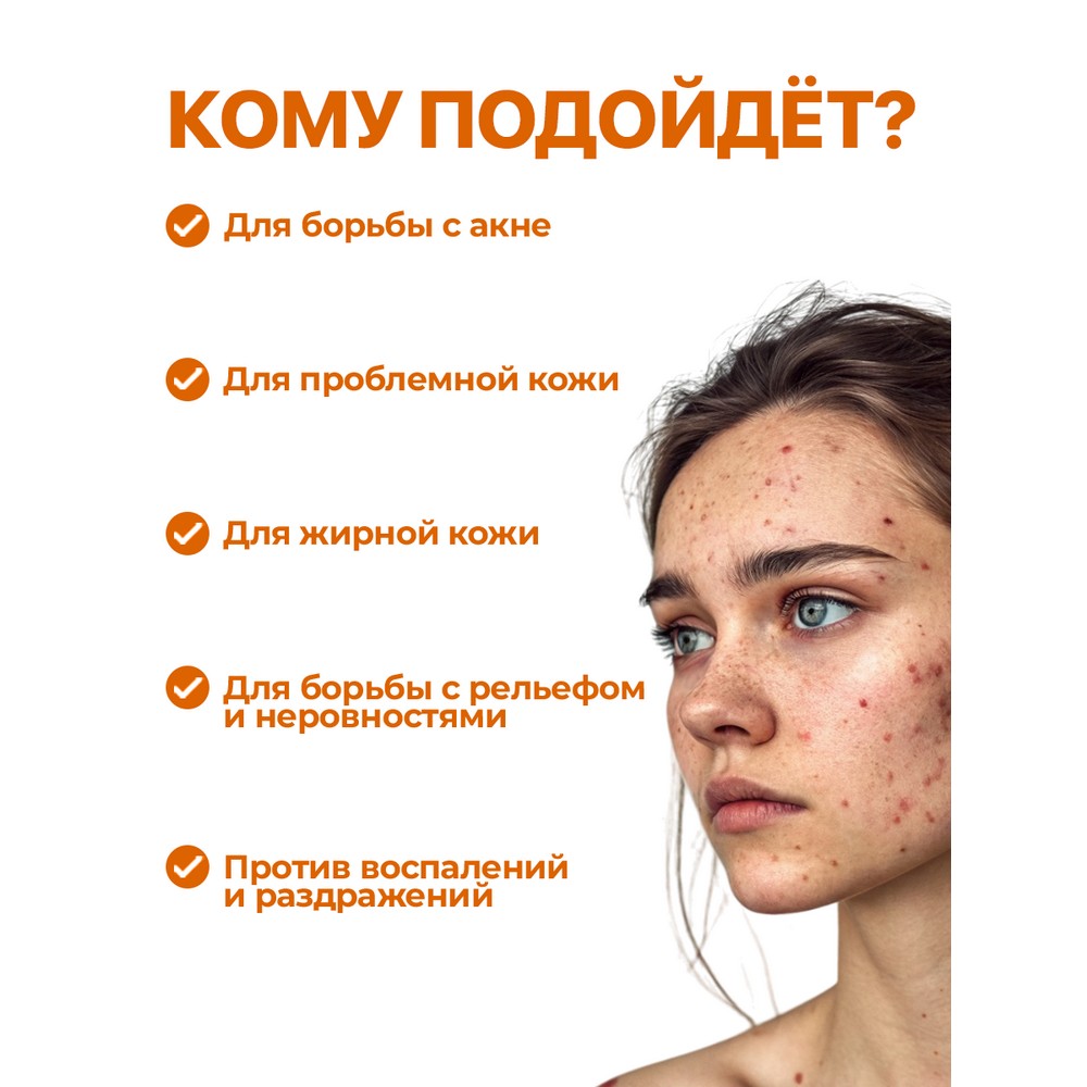 Гель для лица против акне, постакне и черных точек Mentholatum Acnes с экстрактом куркумы 12г. Фото 10.