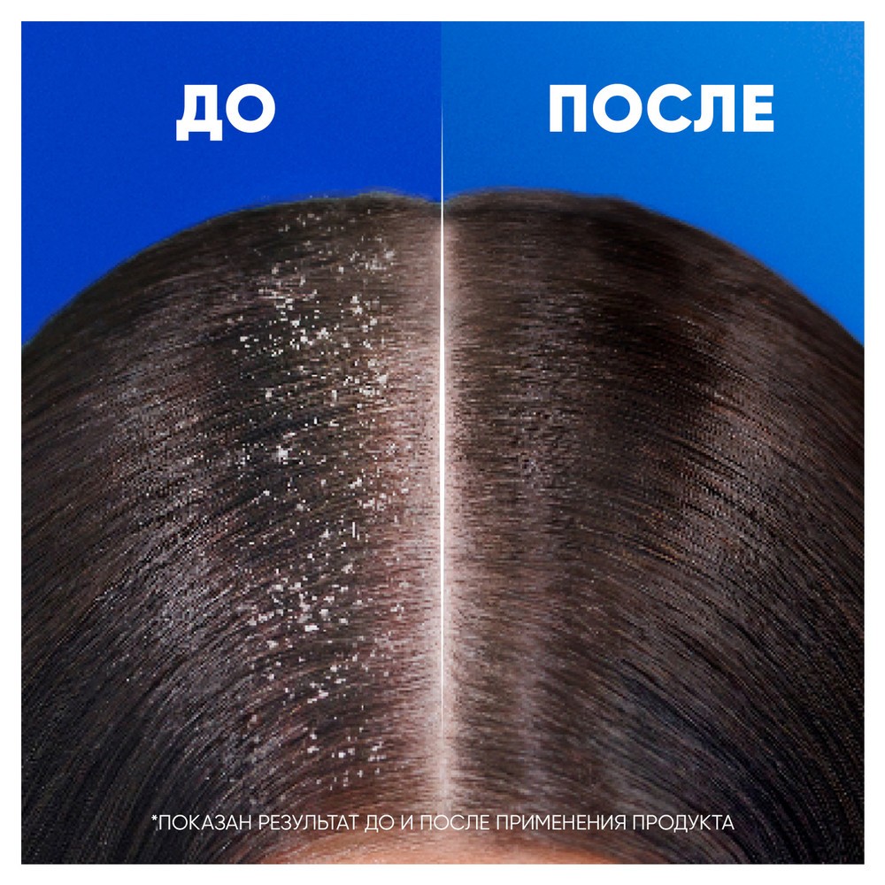 Шампунь для волос против перхоти Head and Shoulders Яблочная свежесть 360мл. Фото 6.