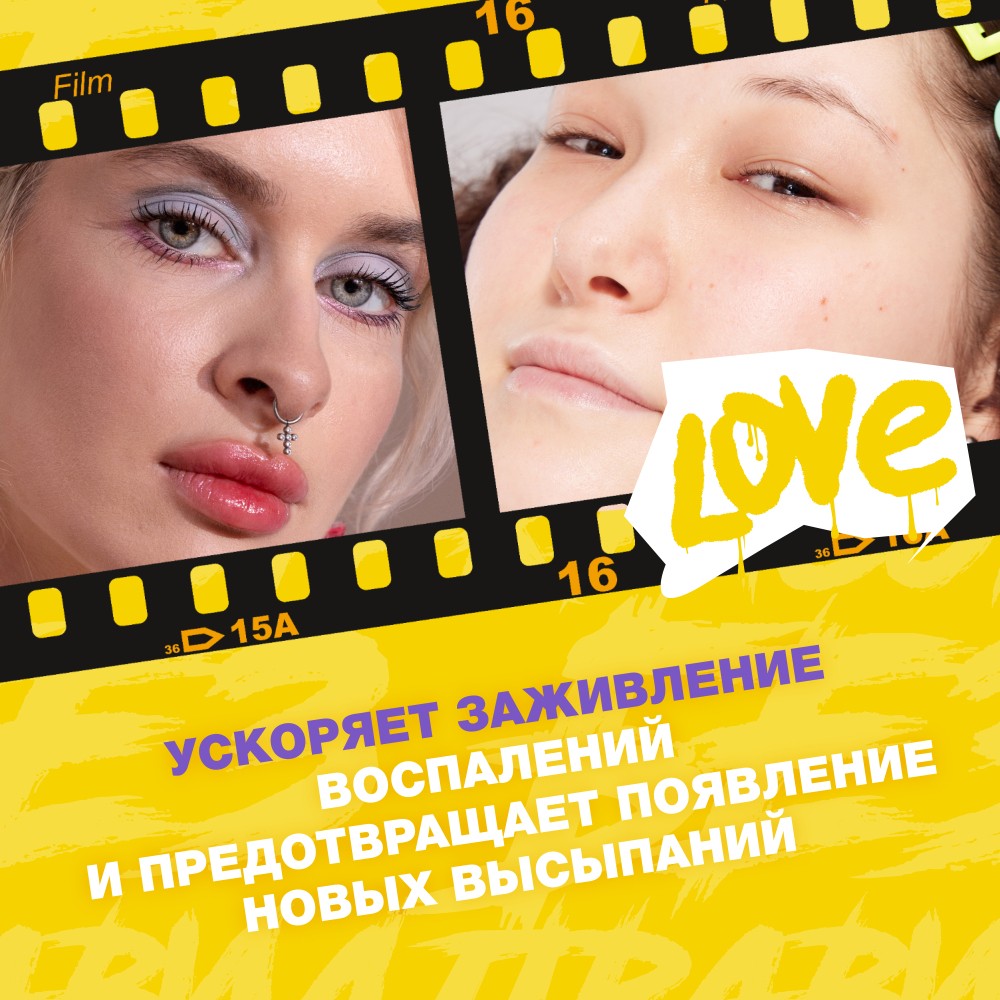 Спрей от от прыщей для лица и тела Beauty Bomb Acne Fighter 65мл. Фото 8.